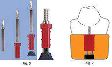 Fig 6 and 7
