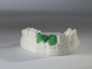 projet-1200-printed-bridge