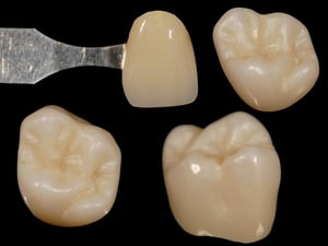 vercore-zirconia-coloring