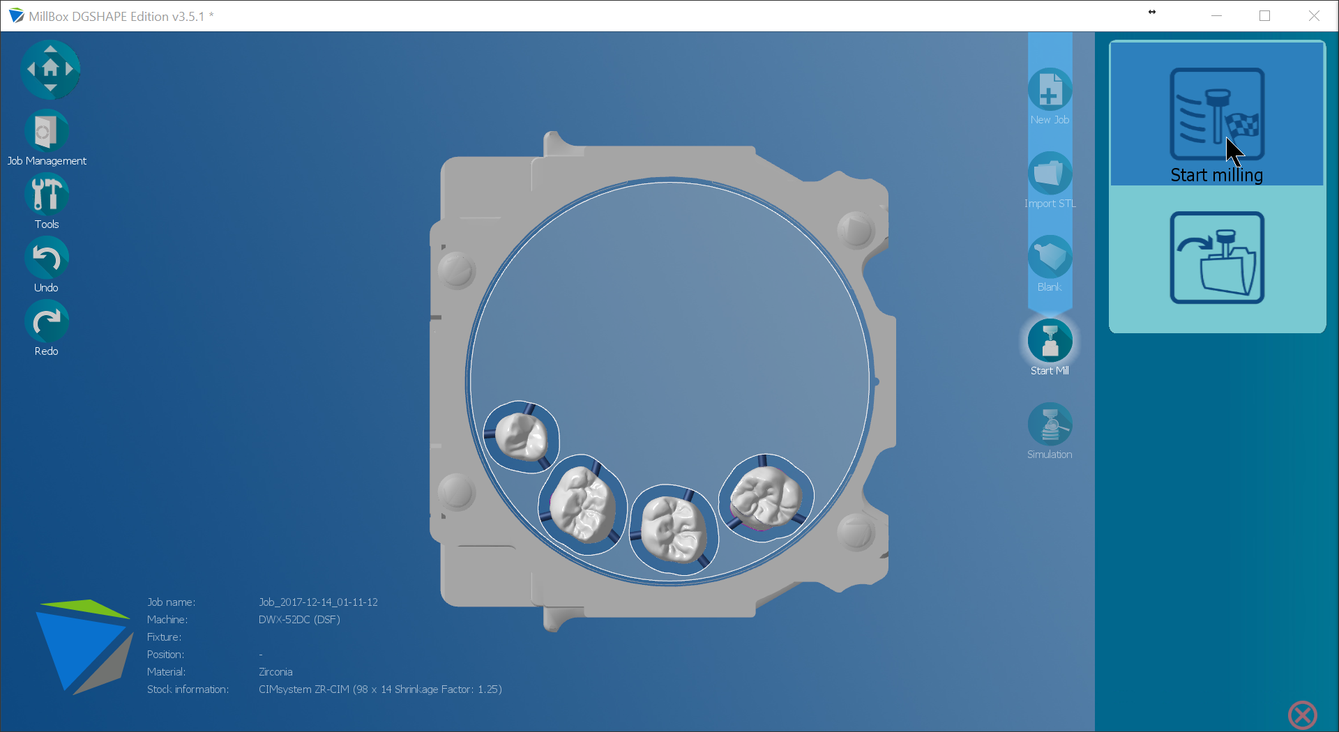 Introducing MillBox A new powerful CAM Interface powered by SUM3D Dental