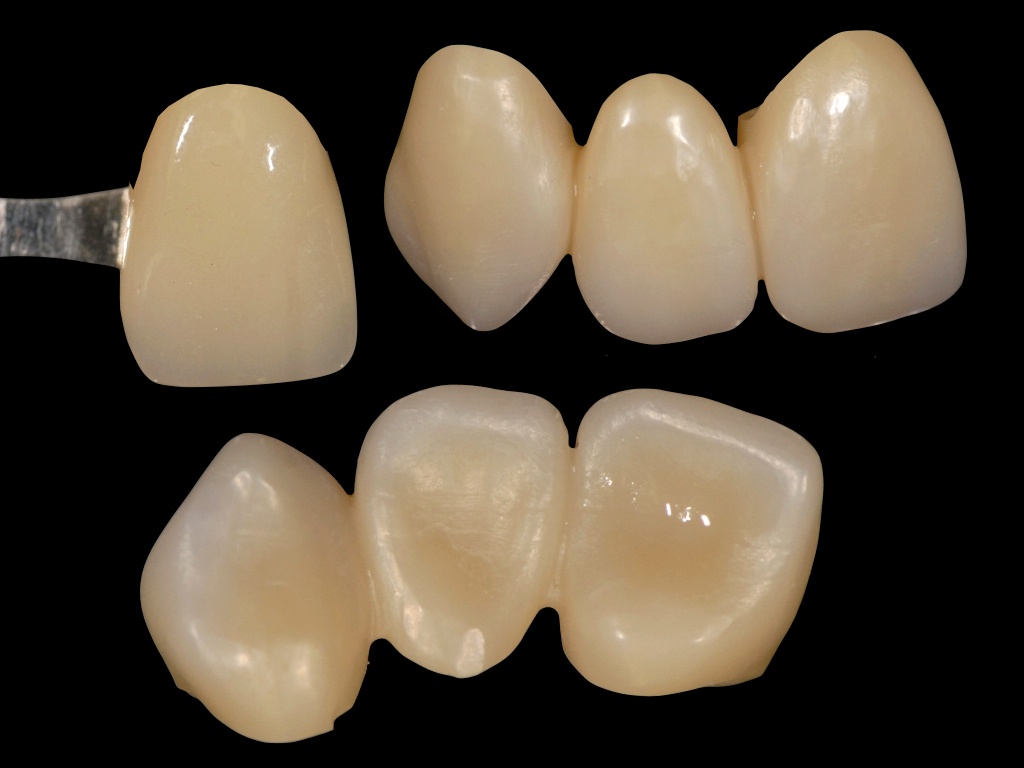 Aren’t all Zirconia Discs the Same? Looking Past Translucency and Strength