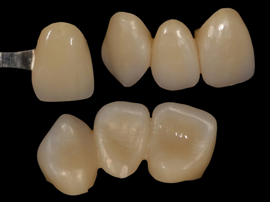 White, Multi-layer, or Shaded Zirconia - Which is right for you?